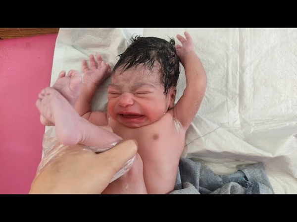 Breech delivery birth of Beautiful Newborn baby is so magical, usa, breech,
